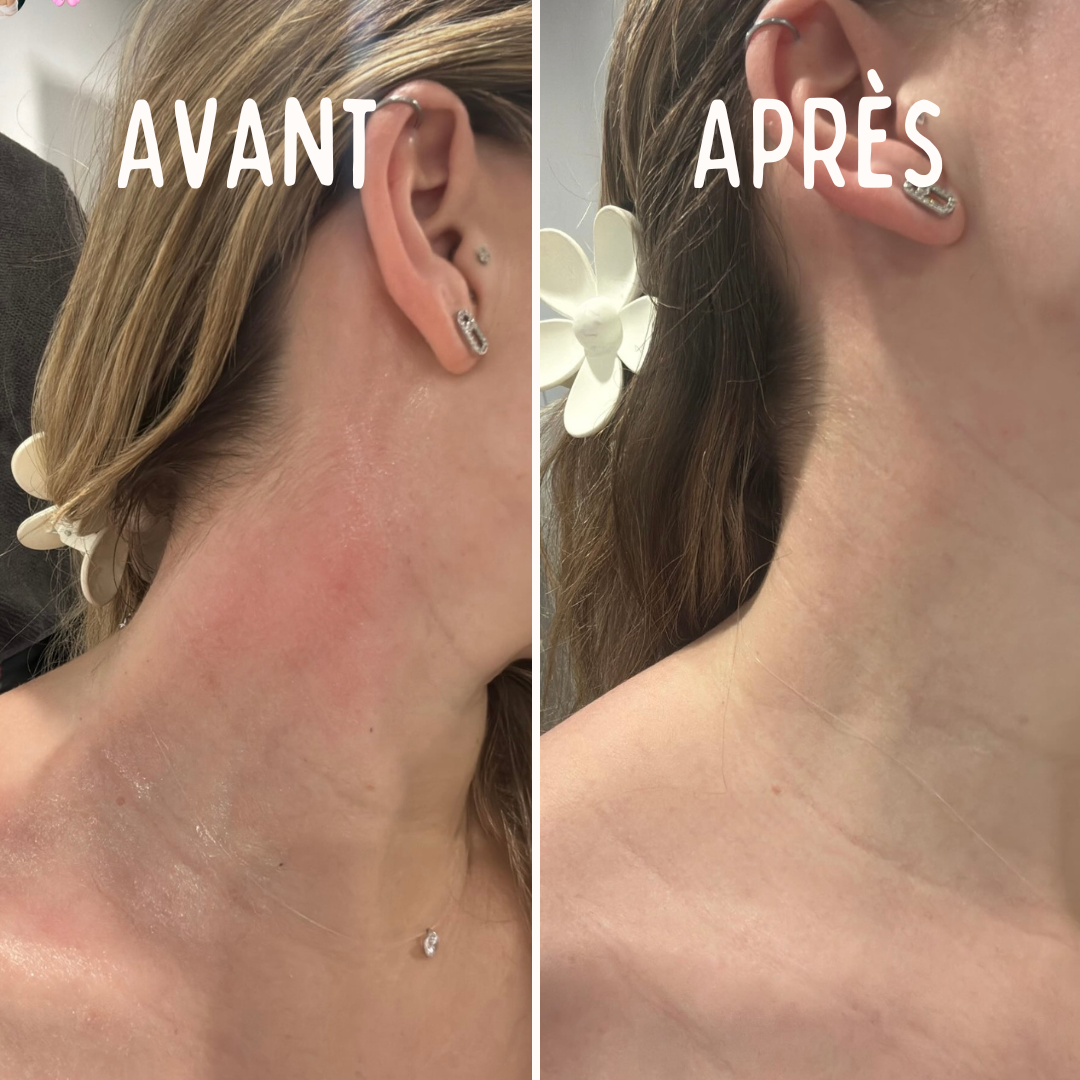 Baume au coeur